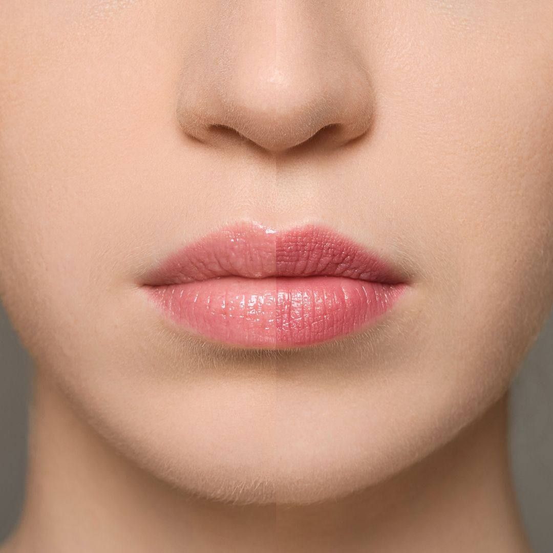 Supreme Lip Treatment — Strawberry MM003